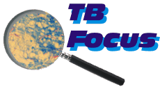 TB Focus