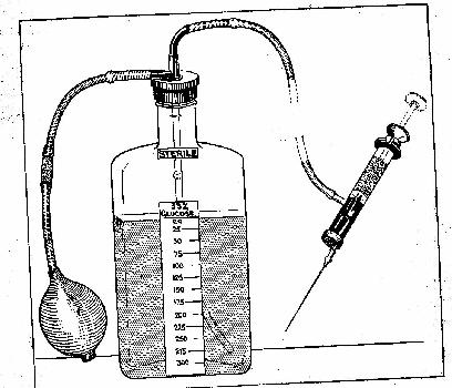 Glucose solution (33%) for reversing coma